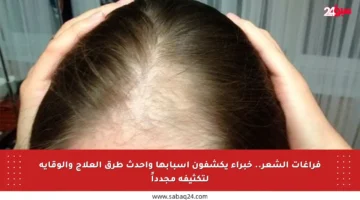 فراغات الشعر.. خبراء يكشفون أسبابها وأحدث طرق العلاج والوقاية لتكثيفه مجدداً